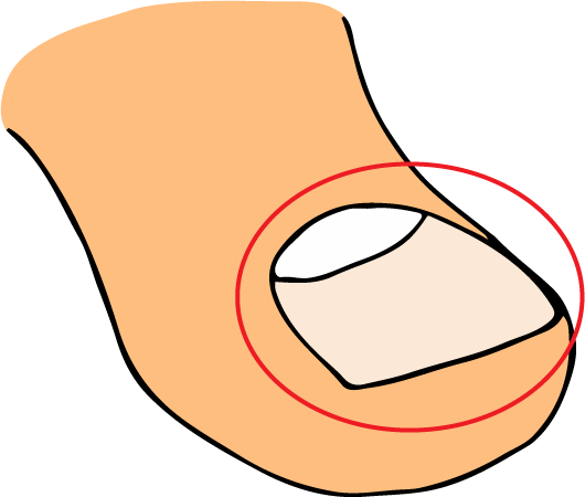 Toenail